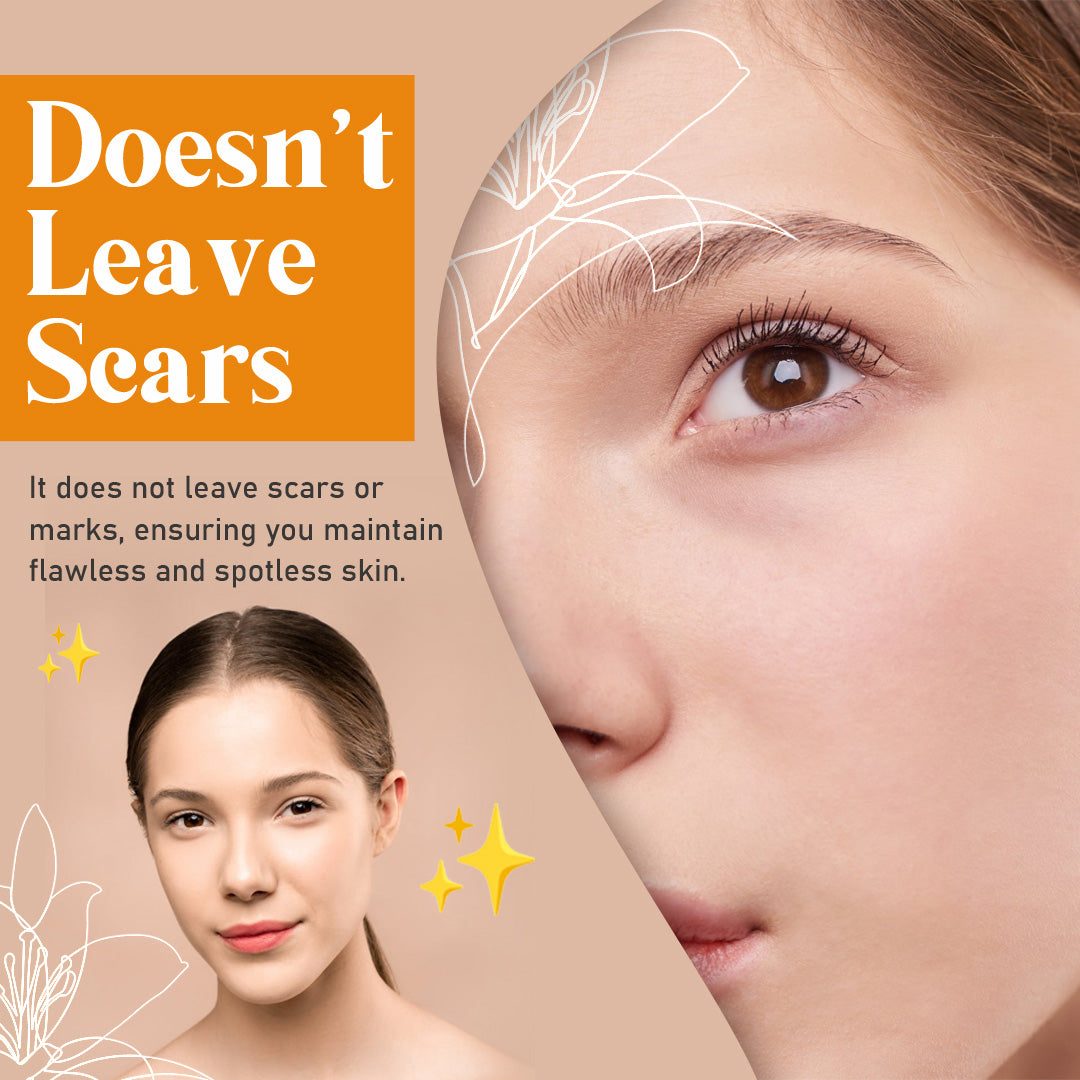 Skin Tag Remover