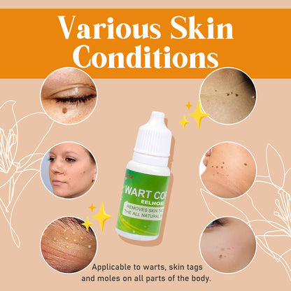 Skin Tag Remover