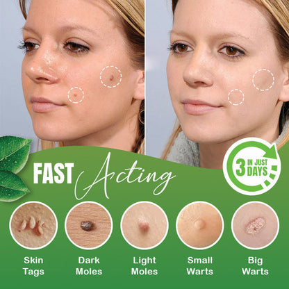 Skin Tag Herbal Removal Patch