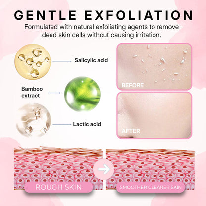 Skin Exfoliating Gel